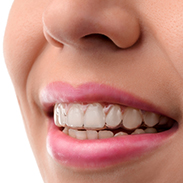 Gainesville Dental Arts Dental Invisalign Related Services