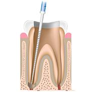 Gainesville Dental Arts Dental Root Canal Related Services