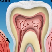 Gainesville Dental Arts Gainesville Hatmarket Healthy And Infected Gum