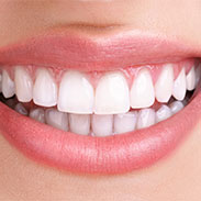 Gainesville Dental Arts Gainesville Haymarket teeth whitning Related services