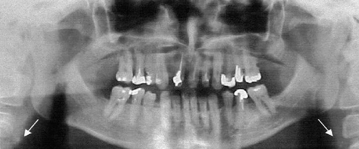 Gainesville Dental Arts Dental X-Ray