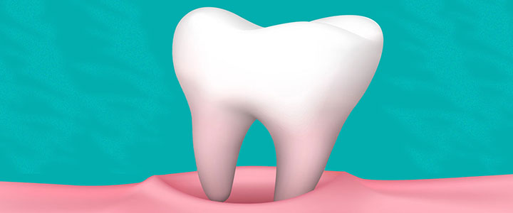Gainesville Dental Arts Gainesville Haymarket Tooth Extraction Representation