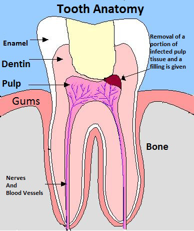 Gainesville Dental Arts Gainesville Haymarket Gentle Professional Pulpotomy Procedure
